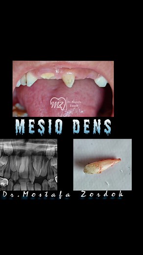 Dr. Mostafa Zordok على TikTok