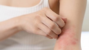 Itchy Red Spots on Your Skin? Don't Ignore This Common but Misunderstood Condition