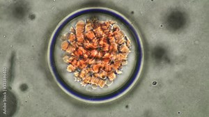 blood under a microscope, a clot of adhering red blood cells, some changed shape