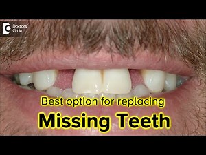 What is the best option for replacing missing teeth? - Dr. Ranjani Rao | Doctors' Circle