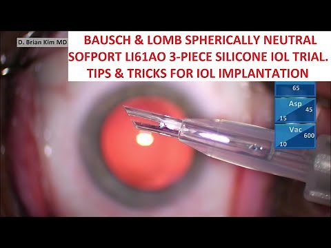 Bausch & Lomb Sofport LI61AO Trial. Tips & Tricks for Easy & Consistent IOL Implantation