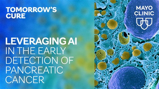 Tomorrow's Cure: Leveraging AI in the early detection of pancreatic cancer - Mayo Clinic News Network