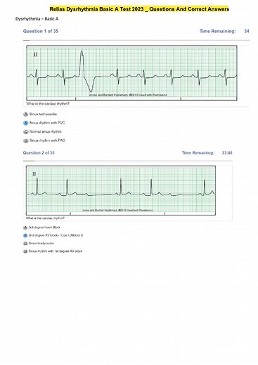 Relias Dysrhythmia Basic A Test 2023 _ Questions And Correct Answers#drregisterednurse #futurenursesoftiktok#nursingstudentsoftiktok#futurenurses#fyp