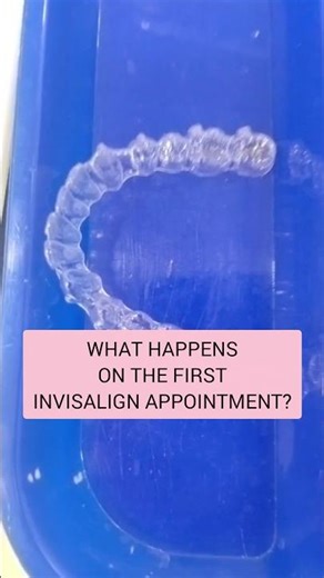 Thinking About Invisalign? Watch This First Visit Guide