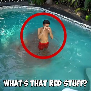 Is That 💩 Or 🩸? | Lucas and Marcus