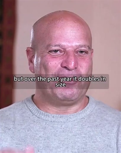 43K views · 127 reactions | The BIGGEST CYST EVER 例  #pimplepopper #drpimplepoppers #cyst #cystremoval #pimplepopping #cyst #cystremoval #pimplepopping #skincareroutine #blackheadremoval #satisfyingvideos | Pimple Treatment | Facebook