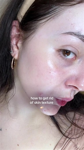 how to improve your skin texture | ‼️ use BHA/retinoids only if you have strong skin barrier. otherwise, first heal your barrier 🙂‍↕️ #skintexture #closedcomedones #acne #comedones #skincaretips