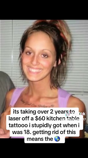 Removing a Kitchen Table Tattoo After 2 Years