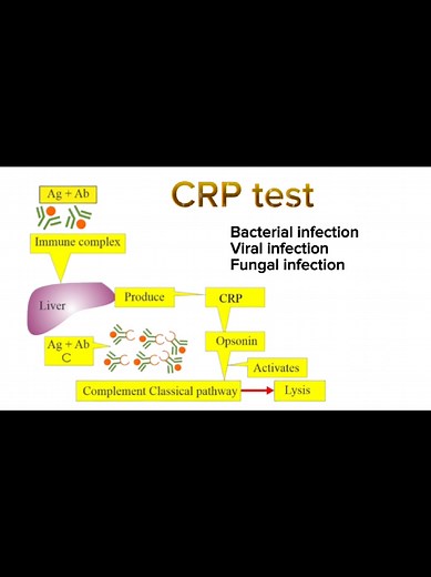 Understanding C-Reactive Protein (CRP) and Inflammation | Medical Knowledge