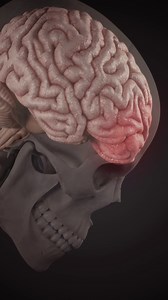 2.7K views · 27 reactions | 易 March is Brain Injury Awareness Month!...