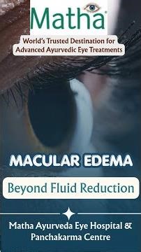 Understanding the Aim of Macular Edema Treatment in Ayurveda