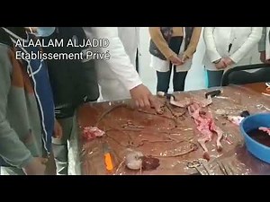 علوم الحياة والارض " تشريح قنية " la dissection d'un lapin