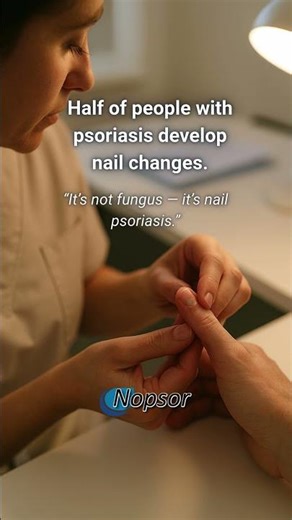 It’s Not Fungus — It’s Nail Psoriasis: Understanding the Difference