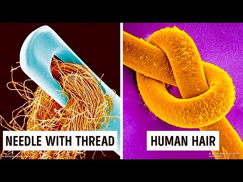 14 Amazing Things Under a Microscope You Can't Unsee