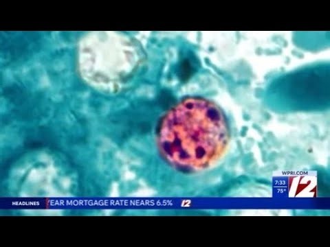 How to stay safe amid ‘explosive’ diarrhea-causing parasitic illness