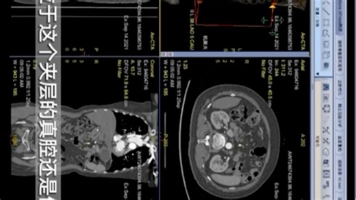 AW4.7CTA后处理一下