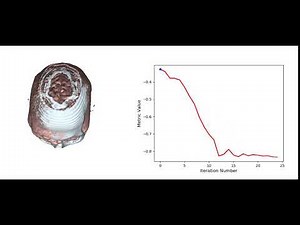 3d Medical Image Registration using SimpleITK