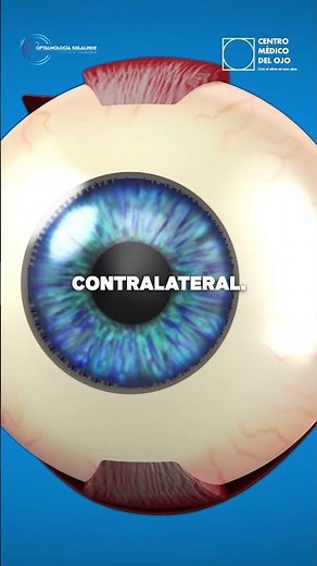 🩺 Did you suffer a retinal detachment in one eye? Medical alert: there is a high risk to your eye
