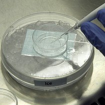 Video: In Vitro Modeling of Cancerous Neural Invasion: The Dorsal Root Ganglion Model