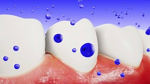 ¿Cómo actúa el barniz protector Fluor Protector S? #odontología #proteccióndental #ivoclarvivadent | Ivoclar (ES, PT - Portuguese, Spanish)