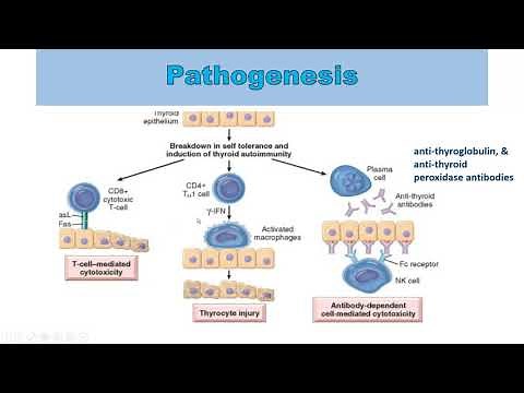 Pathogenesis of Hashimoto thyroiditis