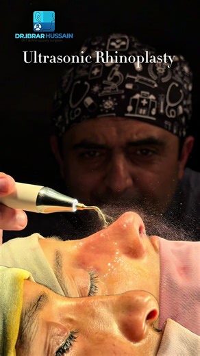 Expert Rhinoplasty in Pakistan with Dr. Ibrar