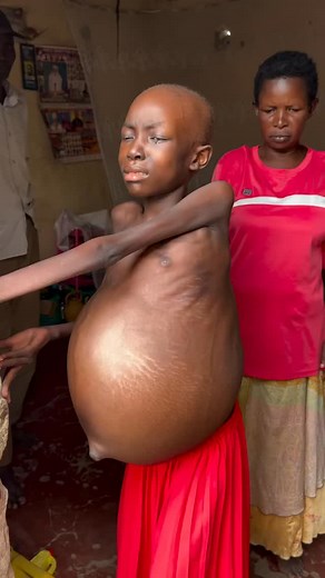 3.3M views · 175K reactions | Hello thanks for the love and affection you show us you can support us through our links on bio or donate needs packages for use your efforts make a huge impact towards us, blessings ⬇️GOFINDME LINK HERE ⬇️ gofundme.com/f/ask5tq-Build-a-school-for-kids/cl/s?lang=en_US&utm_campaign=fp_sharesheet&utm_medium=customer&utm_source=copy_link&attribution_id=sl%253A7003896f-bcb1-4059-9534-fbccbd24c030 | Kato Andrew | Facebook