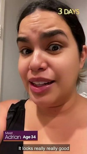 How To Get Rid of a Double Chin? | Sono Bello