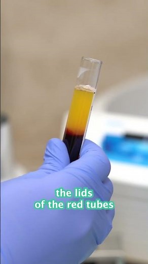 Learn how to make a sticky bone with our PRF Expert, Dr. Richard Miron!