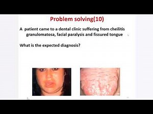 oral pathology practical revision