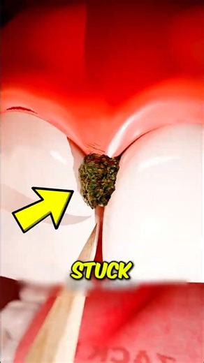 Still using toothpick to remove stuck food in your teeth? Watch This