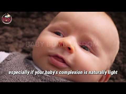 New Born Warning Signs Don't Wait Till You See a Doctor