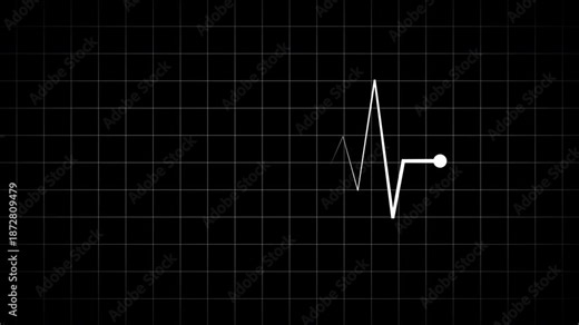 White ECG heartbeat line with circular endpoint on black grid background, clean medical pulse waveform for healthcare monitoring, diagnostics visuals, modern interface design, and technology displays