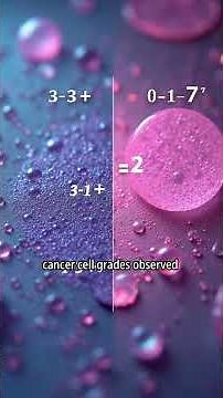 Gleason 7 Explained in 45s | What Gleason 7 Means for Prostate Cancer