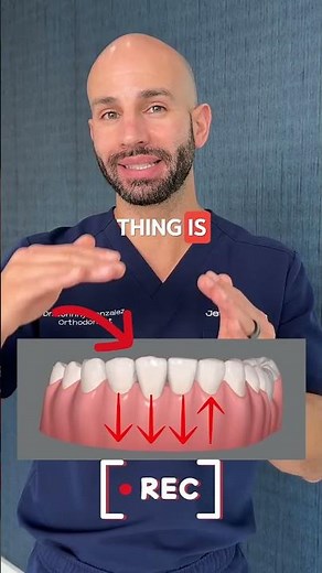 Fixing Curved Lower Front Teeth with Invisalign.