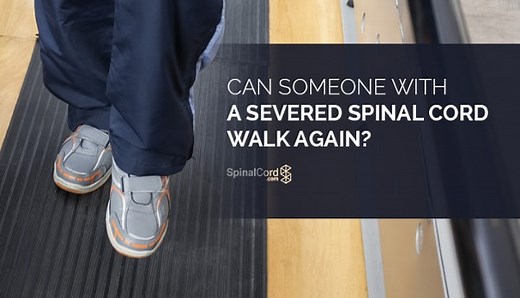 If I Have a Severed Spinal Cord, Will I Ever Walk Again?