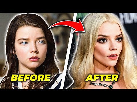 The DARK Truth Behind Anya Taylor Joy’s Face Transformation!