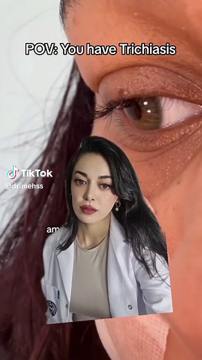 Eyelashes Growing Down & Treatment