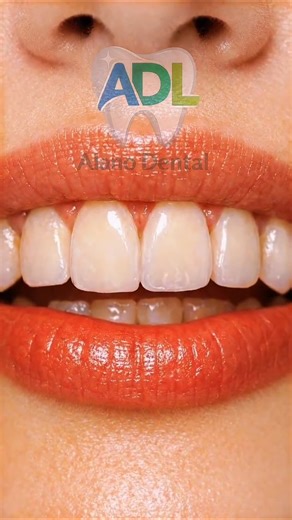 Stop Ruining Your Teeth With TikTok Hacks! (The LEGIT Way to Whiten) ⚠️ #dentist