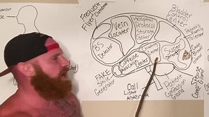 10M views · 58K reactions | The Anatomy of a Nurse's Brain | Ginger Billy | Facebook