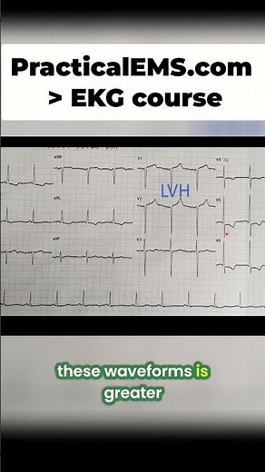 LVH Criteria Explained: Diagnose It With This Simple ECG Trick! #shorts