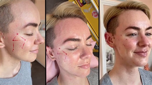 People are getting their zodiac sign constellations tattooed on their faces