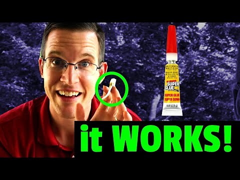 EASY! How To Remove Super Glue From Skin
