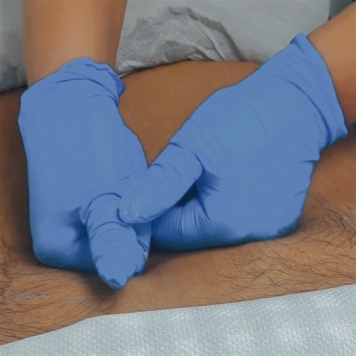 Low back pain doesn’t have to slow you down 💪 Our therapist is performing soft tissue manual release to reduce muscle tension, improve mobility, and relieve pain at its source. Targeted hands-on care can make a real difference in your recovery. 📍Heal 360 Physio & Rehab 📞 Book your appointment today Hashtags: #LowBackPainRelief #PhysiotherapyWorks #ManualTherapy #SoftTissueRelease #PainFreeMovement #BackPainCare #PhysioLife #RehabRecovery #Heal360Physio #BramptonPhysio #BramptonClinic #GTAHeal