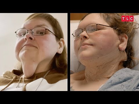 '1000-lb Sisters': Tammy's TRANSFORMATION After Skin Removal Surgery