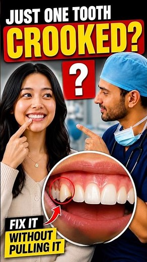Just One Tooth Crooked? 🦷 Here’s How Dentists Fix It (Without Pulling It)