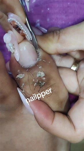 Effective Toenail Cleaning Techniques