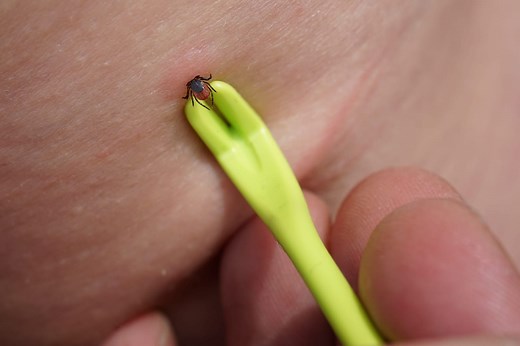 Enlever une tique : tire-tique, pince, huile, alcool, comment ?