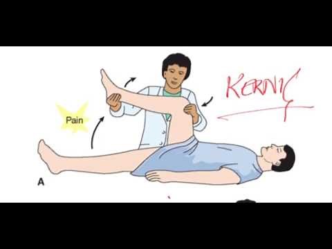 Central Nervous System (CNS) examination