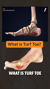 233K views · 247 reactions | Turf toe: If serious injury, why cute name? ‍ | Yahoo Sports | Facebook